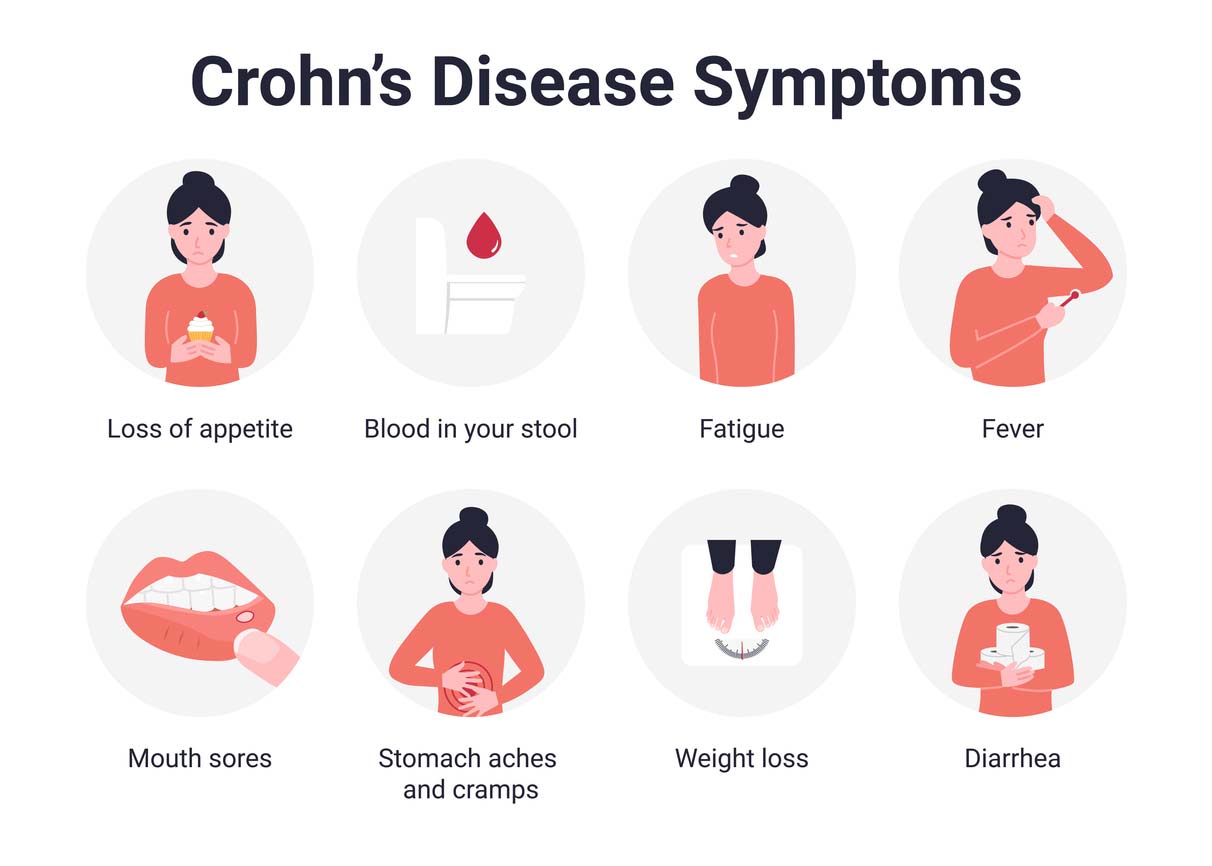 Crohns-Disease-Symptoms