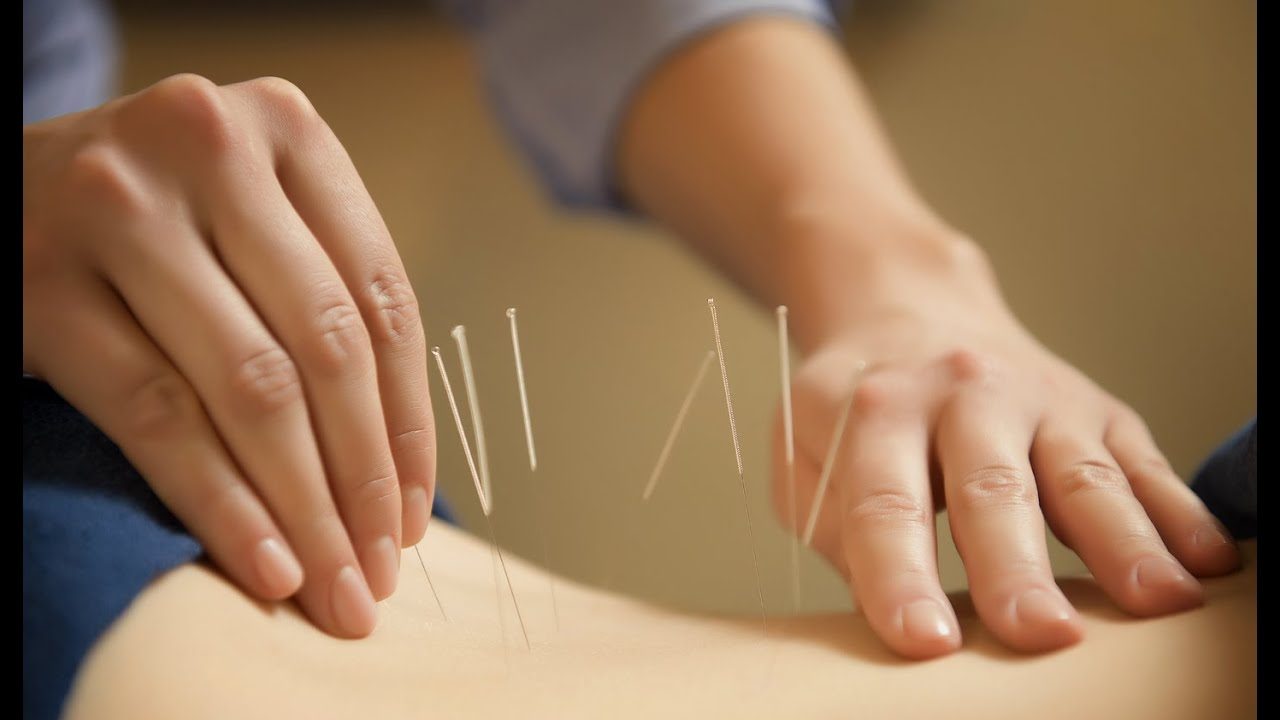 Exploring the Benefits of Alternative Therapies: From Acupuncture to Aromatherapy